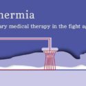 Cancer: Oncothermia