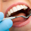 Dentistry: Dental Amalgams And Their Contribution To Chronic Disease
