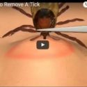 Lyme Disease: How To Remove A Tick