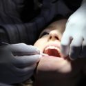 Root Canal Education